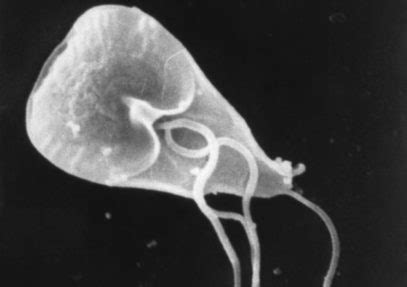  Giardia! The Microscopic Marvel Lurking In Your Water Supply